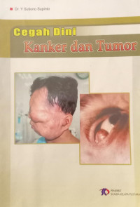 Image of Cegah dini kanker dan tumor